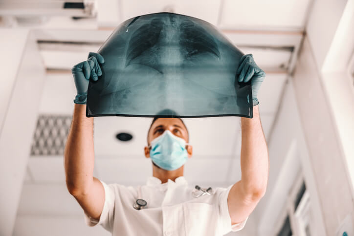 X Ray technician looking at x ray of lungs